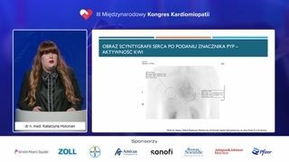 Znaczenie SPECT-CT i ograniczenia diagnostyki