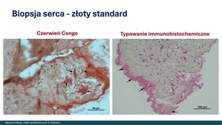 Podsumowanie, czerwone flagi i rekomendacje dotyczące skierowań