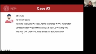 T1 mapping, extracellular volume and case review