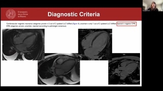 Limitations of CMR and the role of endomyocardial biopsy