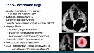 Obrazowanie serca: echo, rezonans i scyntygrafia