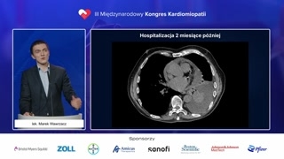 Pierwszy przypadek: historia i ablacje