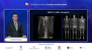 Drugi przypadek: przewlekły płyn osierdziowy, diagnostyka i dylemat biopsji