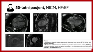 Rola rezonansu magnetycznego i kryteria Lake Louise