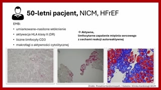 Biopsja, leczenie immunosupresyjne i wynik kliniczny