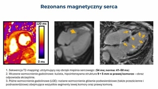 Leczenie, powikłania, rehabilitacja i wnioski końcowe