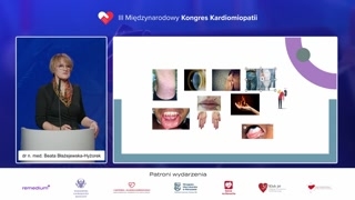 Epidemiologia i główne zajęte narządy