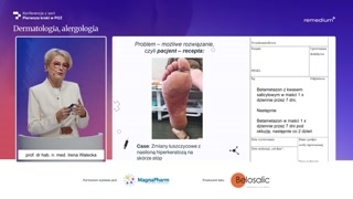 Atopowe zapalenie skóry, wyprysk i obawy pacjentów