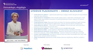 Obraz kliniczny i postaci łysienia plackowatego