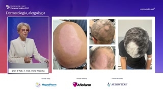 Program lekowy, przypadki kliniczne i perspektywy