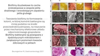Racjonalna antybiotykoterapia i wybór probiotyku