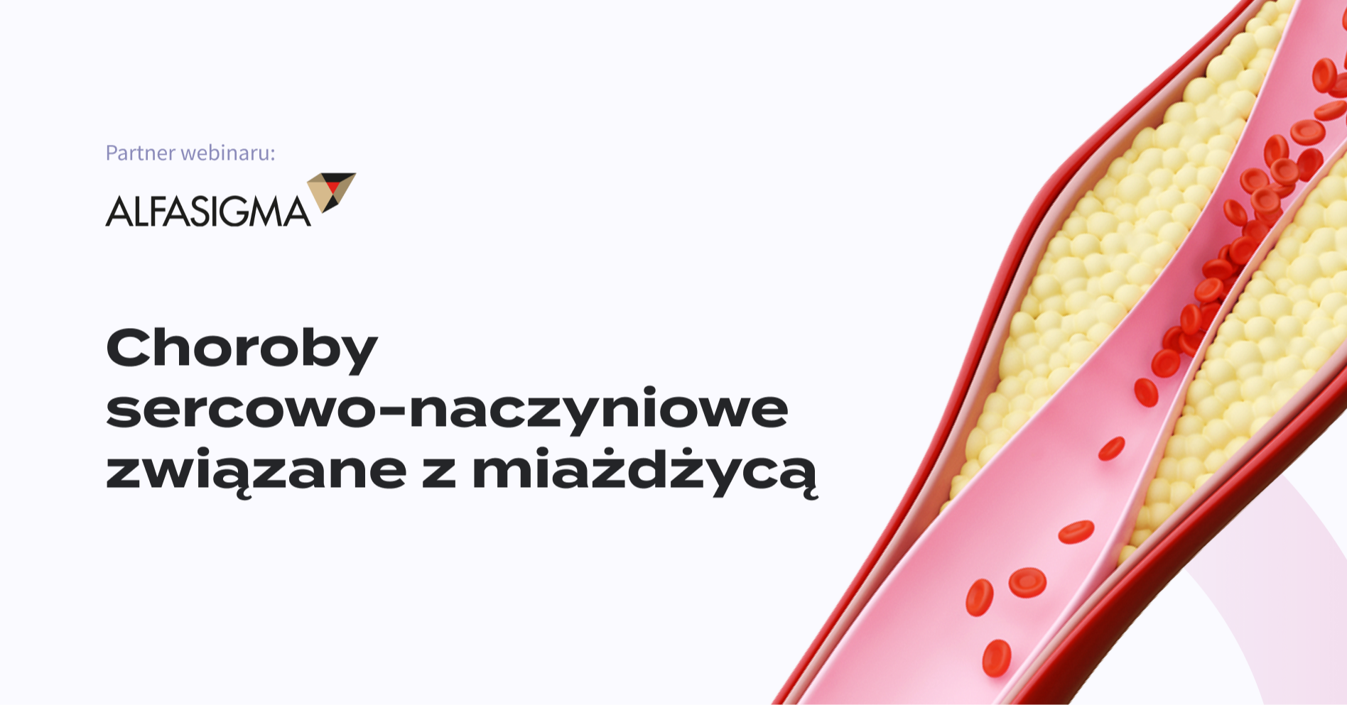 Choroby sercowo-naczyniowe związane z miażdżycą - możliwości leczenia farmakologicznego. Debata chirurgiczno-kardiologiczna