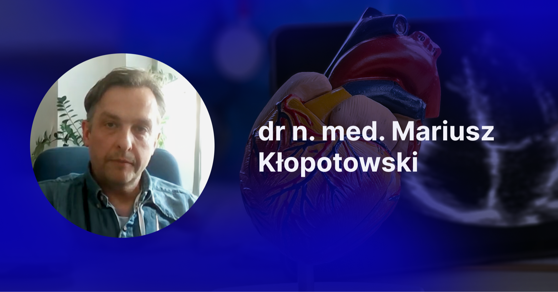 Spojrzenie kardiologa