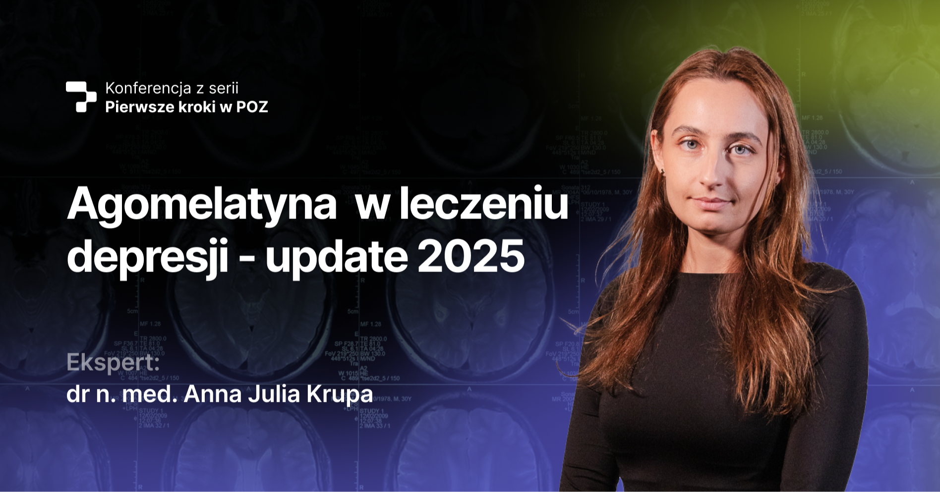 Agomelatyna w leczeniu depresji – update 2025 (VOD)