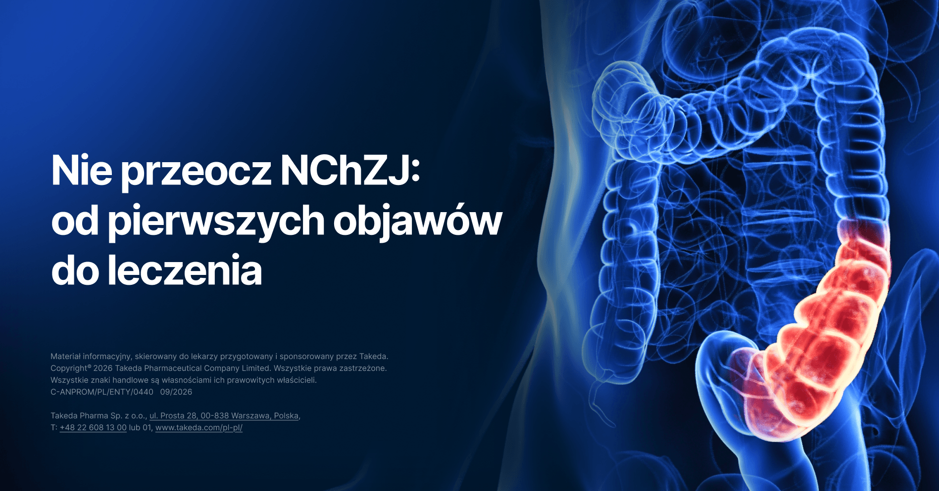 Nie przeocz NChZJ: od pierwszych objawów do właściwej diagnostyki i leczenia